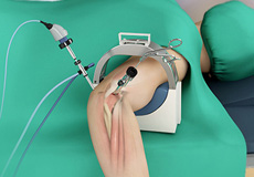 Elbow Arthroscopy