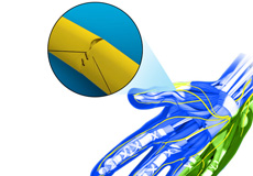 Peripheral Nerve Repair