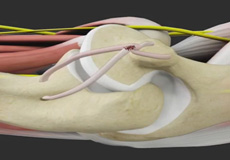 UCL Reconstruction